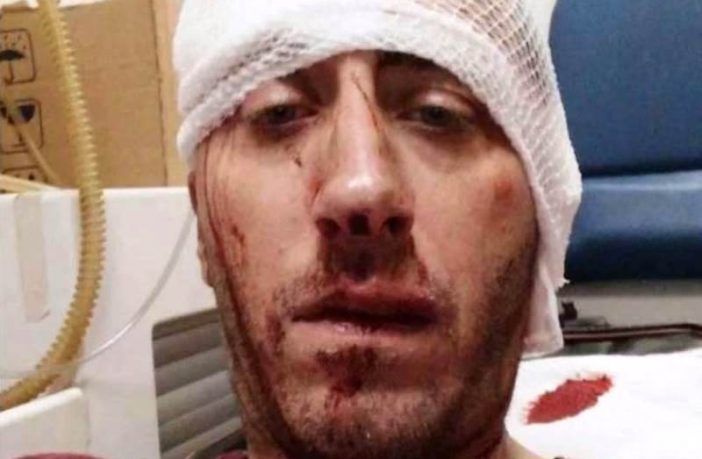 Ušutkivanje metalnim palicama: Brutalno pretučen novinar BH TV Vladimir Kovačević